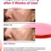 ANUA NIACINAMIDE 10% + TXA 4% SERUM - 30ML | أنوا سيروم النياسيناميد 10% + حمض الترانكسميك 4% - 30 مل