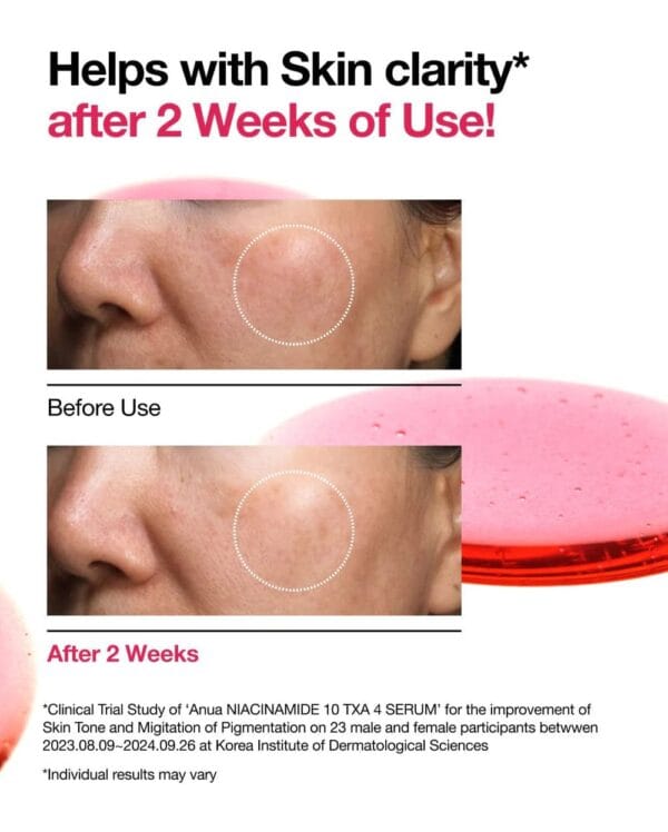 WhatsApp Image 2025-09-13 at 09.02.38_4d15a504 ANUA NIACINAMIDE 10% + TXA 4% SERUM - 30ML | أنوا سيروم النياسيناميد 10% + حمض الترانكسميك 4% - 30 مل
