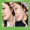 ANUA AZELAIC ACID 10 HYALURON REDNESS SOOTHING SERUM - 30ML | أنوا سيروم الآزليك اسيد المهدئ للبشرة - ٣٠ مل
