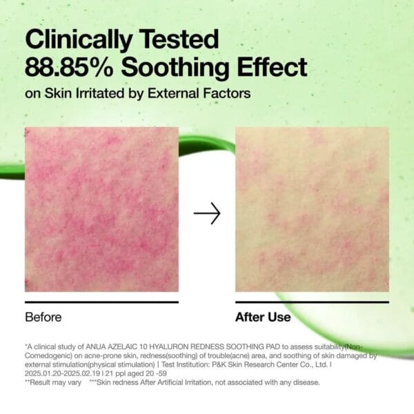 WhatsApp Image 2025-09-13 at 09.07.56_3dd5b0fc ANUA SOOTHING PAD AZLAIC10 + HYALURON - 90PADS | أنوا تونر بالأزليك اسيد و الهيالورونيك اسيد - 90 قطعة
