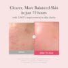 Medicube TXA+Niacinamide 15% Glow Facial Serum | مديكيوب سيروم النضارة بحمض الترانكسامك والنايسنمايد - 30 مل