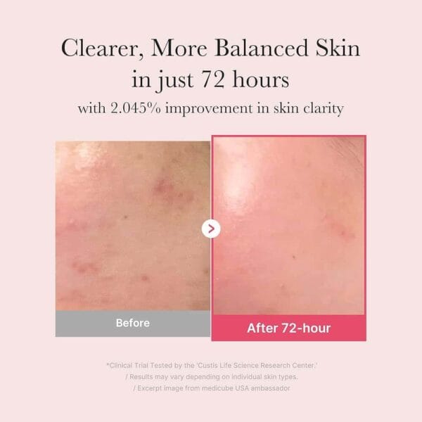 Medicube TXA+Niacinamide 15% Glow Facial Serum | مديكيوب سيروم النضارة بحمض الترانكسامك والنايسنمايد - 30 مل