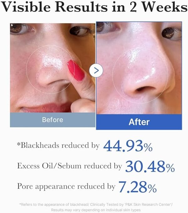 Medicube ZERO PORE PAD  - 70pcs | مديكيوب وسائد تونر - 70 قطعة