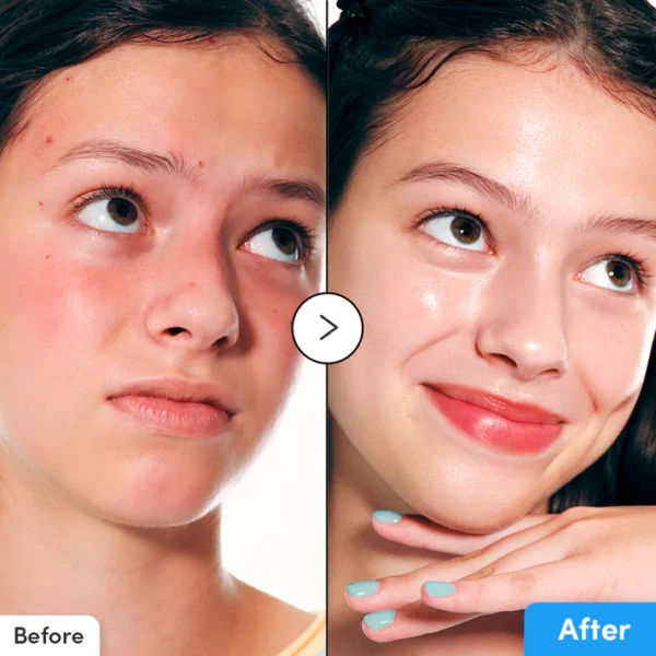 EQQUALBERRY Hyaltoin Flooding Serum - 30ml |  إيكوال بيري سيروم الترطيب الفائق – 30 مل