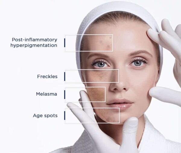 RILASTIL D-Clar Depigmenting Concentrate Drops - 30ml | ريلاستيل سيروم مركز لعلاج تصبغات البشرة - 30 مل