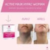 Hyfac Woman Active Mask Peel-Off Mask - 15 Sachets | هايفك ماسك لحبوب الوجه عند البالغين - 15 قطعة