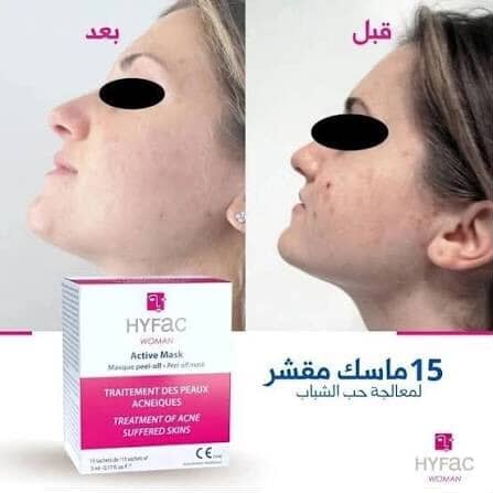 Hyfac Woman Active Mask Peel-Off Mask - 15 Sachets | هايفك ماسك لحبوب الوجه عند البالغين - 15 قطعة