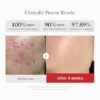 618fASNTI5L._SX466_ Medicube RED Succinic Acid Peeling Pad - 70pads | مديكيوب - وسادات التقشير بحمض السكسينيك (70 قطعة)