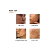 Skarfix-TX Cream | Effective treatment for melasma and dark spots - 30ml | كريم سكارفيكس - تي إكس (Skarfix-TX) | العلاج الفعال للكلف والبقع الداكنة - 30 مل