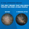 Rogaine Regrowth Foam 5% Unscented 3mo Supply Minoxidil Hair Treatment - 3x60g | روجين رغوة لعلاج تساقط الشعر - 5% مينوكسيديل للرجال - 3x60 غ