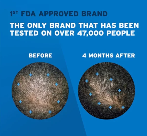 Rogaine Regrowth Foam 5% Unscented 3mo Supply Minoxidil Hair Treatment - 3x60g | روجين رغوة لعلاج تساقط الشعر - 5% مينوكسيديل للرجال - 3x60 غ