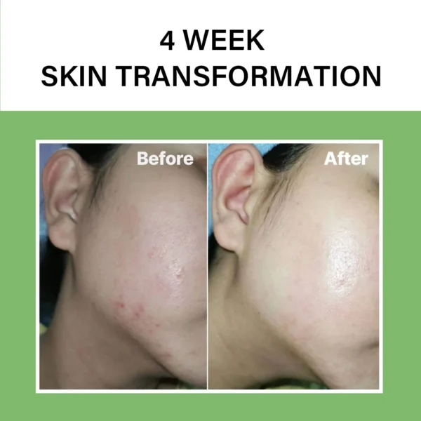 WhatsApp_Image_2025-03-03_at_15.18.43_a693528b Celimax Noni Ampoule Calming + Radiance - 30ml | سليماكس سيروم مهدئ و مضيئ للبشرة بمستخلص النوني - 30 مل