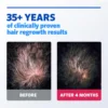 ROGAINE® 5% Minoxidil Solution - 3-Month Supply - 3x60ml | روكين محلول مينوكسديل 5% كورس علاجي لمدة 3 أشهر لإعادة نمو الشعر - 3x60 مل