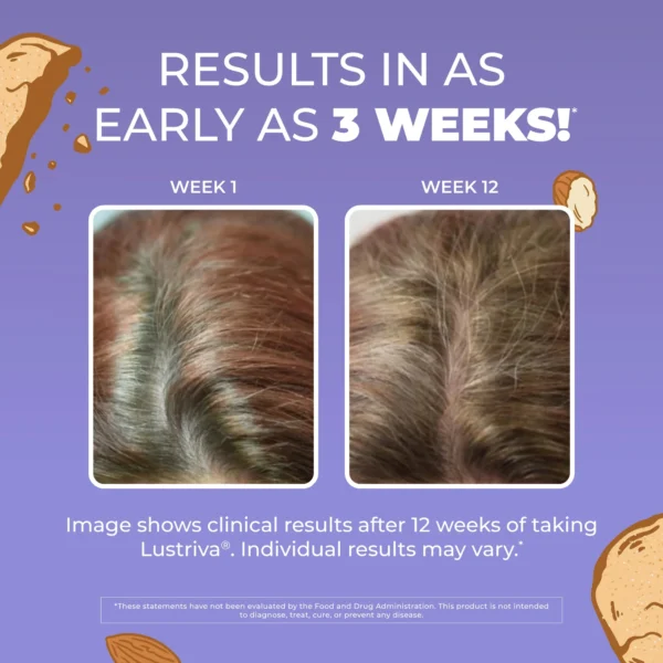 Mary Ruths Hair Growth Max Liposomal Liquid Supplement Almond Cookie - 450ml | ماري روث مكمل غذائي سائل ليبوزومي بنكهة كوكي اللوز لدعم صحة الشعر - 450 مل