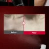 L_g0217131719_001 medicube Red Acne Body Peeling Shot - 110g | مديكيوب مقشر الجسم الأحمر - 110 غ