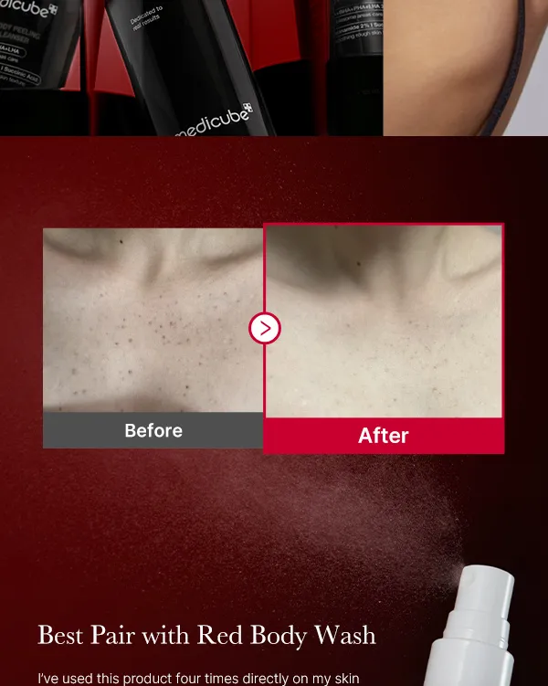 L_g0217131719_001 medicube Red Acne Body Peeling Shot - 110g | مديكيوب مقشر الجسم الأحمر - 110 غ